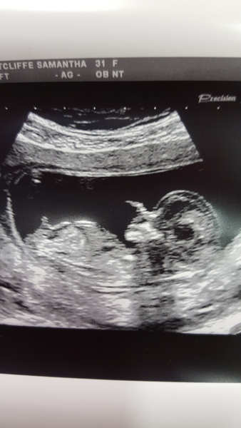 February 2016 Babies - The time for scans is fast approaching!