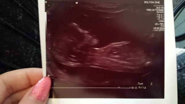 Jan 2016 #7 - headaches and exhaustion but 1/3 through