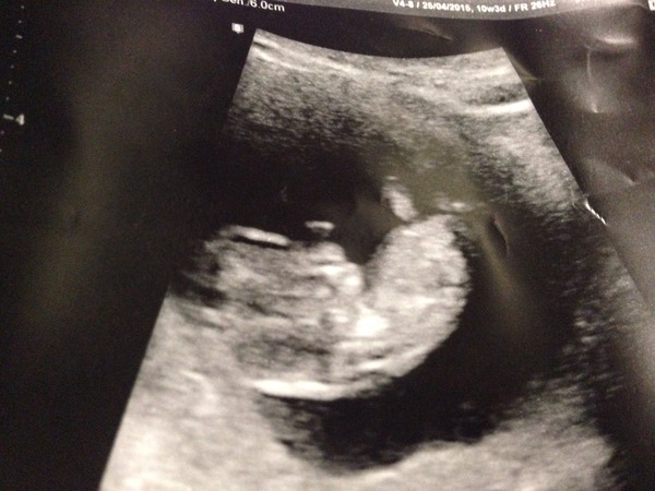 February 2016 - Will the chundering ever cease?!