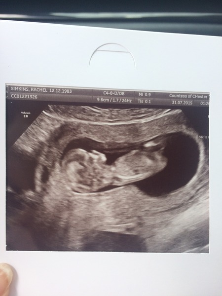 February '16 approaching and conquering the 12 week mark!