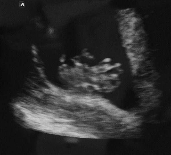 February 2016 Babies - The time for scans is fast approaching!