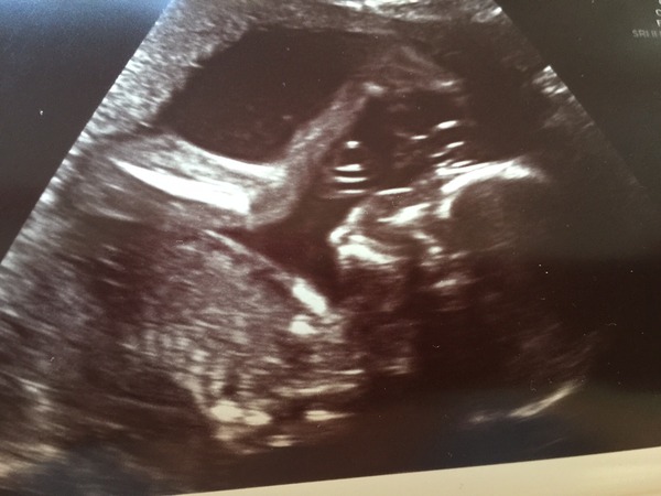 November 2015 Thread - Teams Yellow, Pink and Blue selection has started!