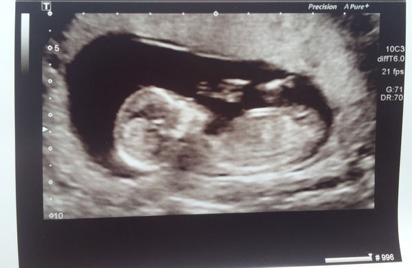 Jan 2016 #7 - headaches and exhaustion but 1/3 through