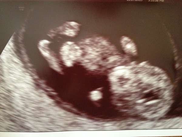 February 2016 Babies - The time for scans is fast approaching!