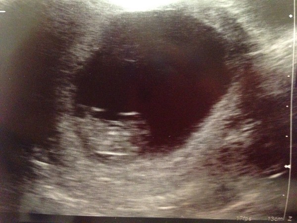 February 2016 Babies - The time for scans is fast approaching!