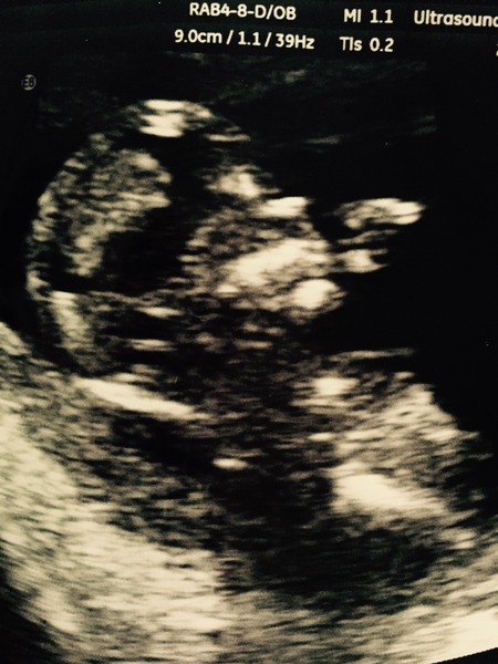 February '16 approaching and conquering the 12 week mark!