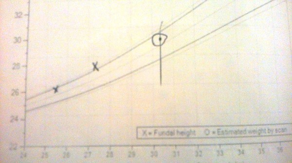 30+3 - baby's estimated weight is 3lb12 already...