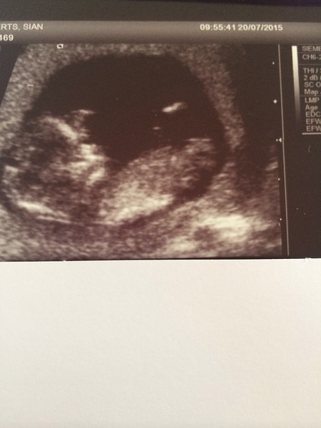 February 2016 Babies - The time for scans is fast approaching!