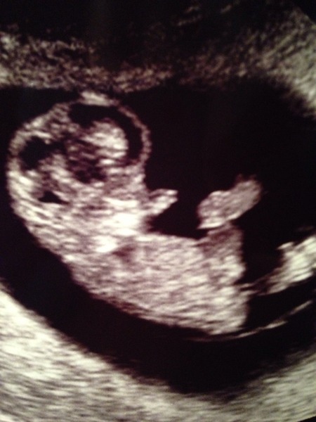 Plenty of chocolate and support all round - #5 posifrickintive thread for those pregnant after miscarriage