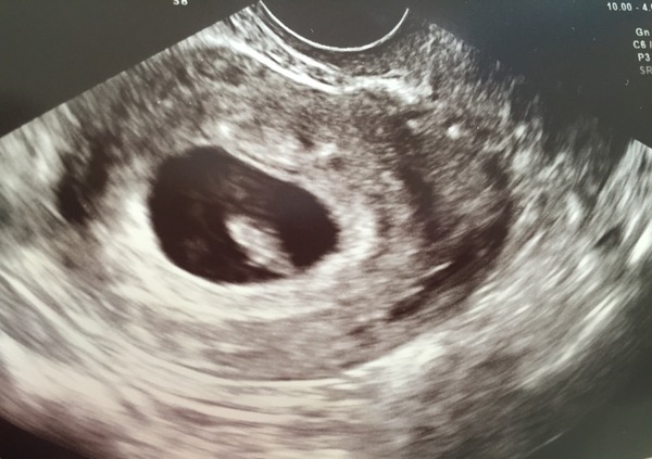 February 2016 - Will the chundering ever cease?!