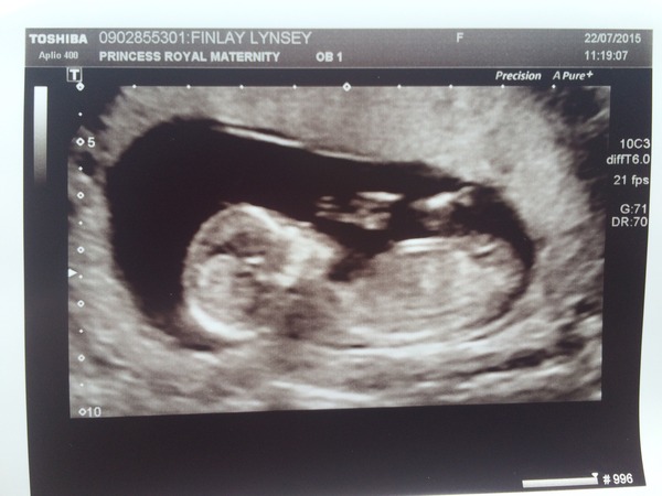 Jan 2016 #6 ....bumps and blooming ahoy!