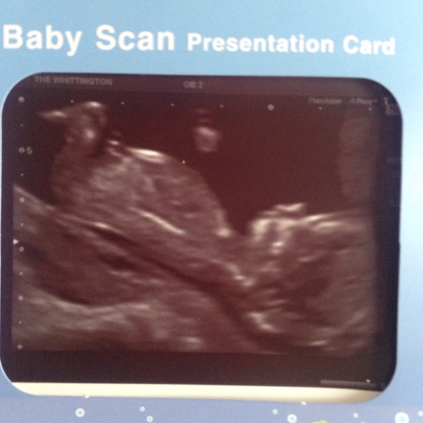 Jan 2016 #7 - headaches and exhaustion but 1/3 through