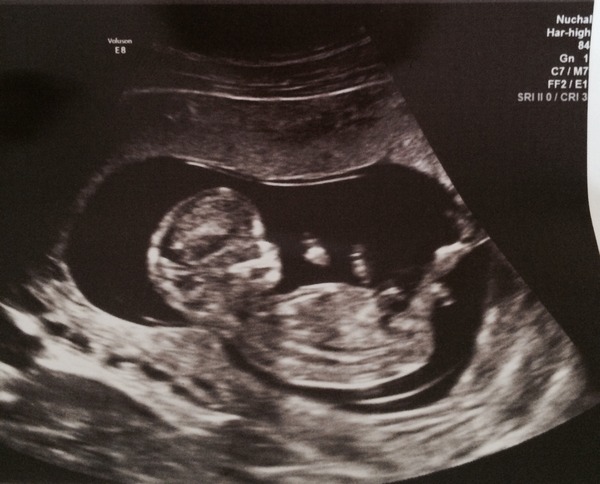 Jan 2016 #7 - headaches and exhaustion but 1/3 through