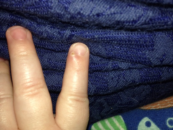 What is this on my 10mo finger? (Picture included)
