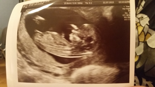 Due February 2016 - first timers