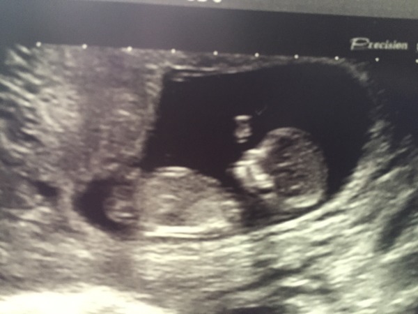 February '16 approaching and conquering the 12 week mark!