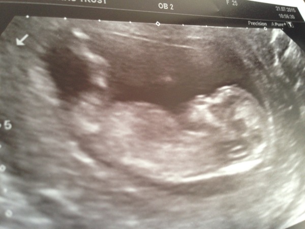 February 2016 Babies - The time for scans is fast approaching!