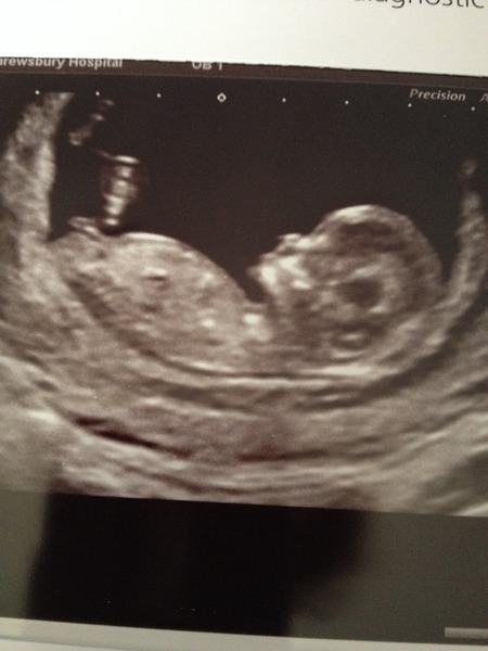 Jan 2016 #6 ....bumps and blooming ahoy!