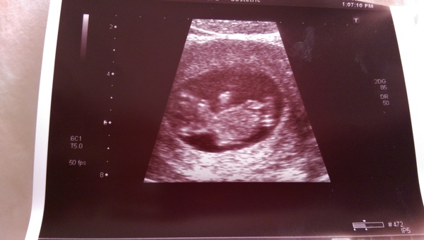 February 2016 Babies - The time for scans is fast approaching!