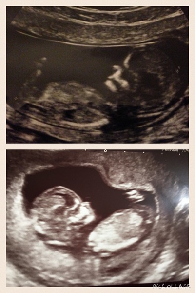 Jan 2016 #6 ....bumps and blooming ahoy!