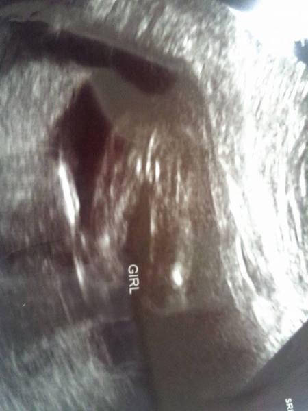 Gender scan