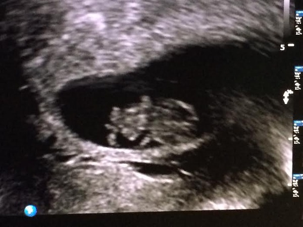 February 2016 - Will the chundering ever cease?!