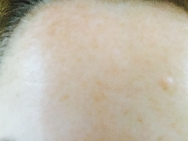 to be suspicious of older women with totally smooth foreheads!