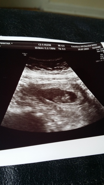 Waving our pom-poms for the thread that FINALLY welcomes MiniLa, it's carb-tastic, all day sickness and when the hell can I nap? On JS 34!