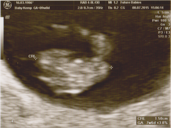 February 2016 - Will the chundering ever cease?!