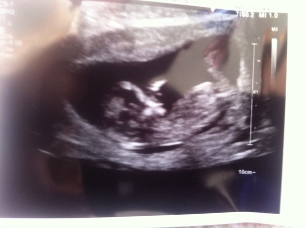 Jan 2016 #6 ....bumps and blooming ahoy!