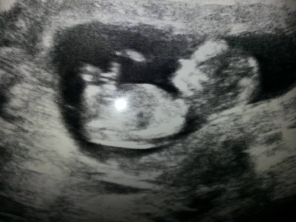February 2016 Babies - The time for scans is fast approaching!