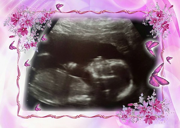 Gender scan