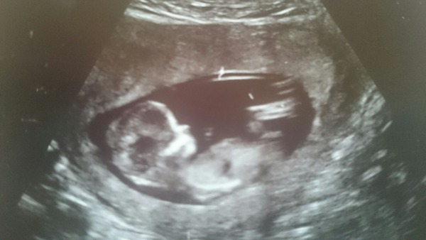 Jan 2016 #7 - headaches and exhaustion but 1/3 through