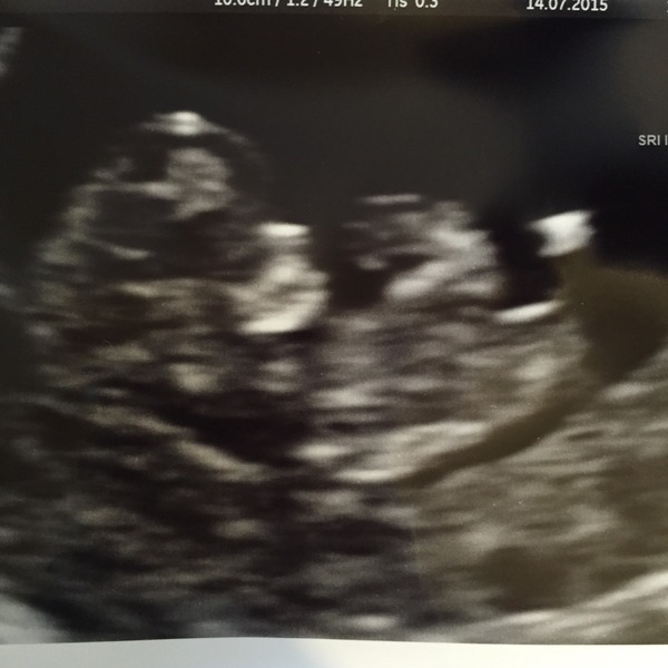 February 2016 Babies - The time for scans is fast approaching!