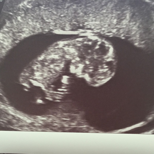 February 2016 - Will the chundering ever cease?!