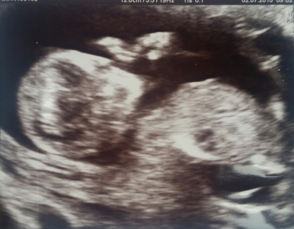 Jan 2016 #6 ....bumps and blooming ahoy!