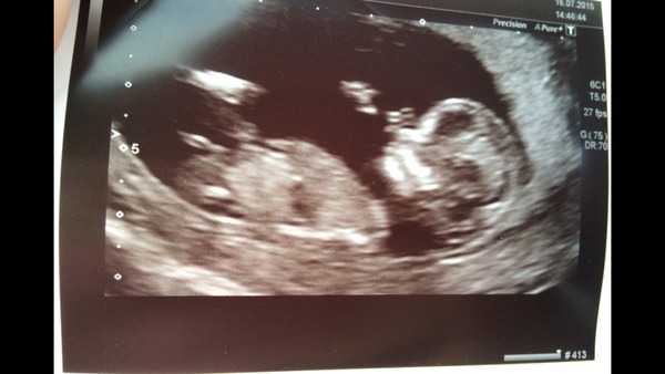 Jan 2016 #6 ....bumps and blooming ahoy!