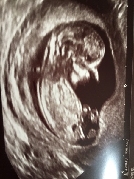 Jan 2016 #6 ....bumps and blooming ahoy!