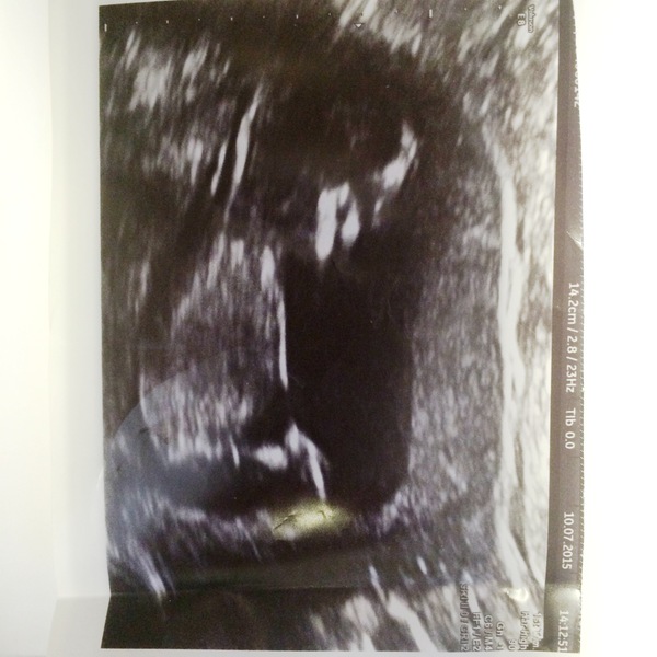 Jan 2016 #6 ....bumps and blooming ahoy!