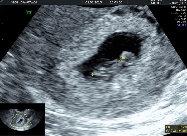 February 2016 - Will the chundering ever cease?!