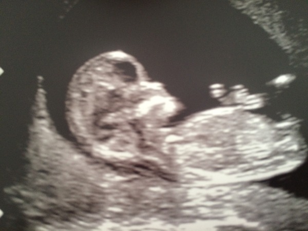 February '16 approaching and conquering the 12 week mark!