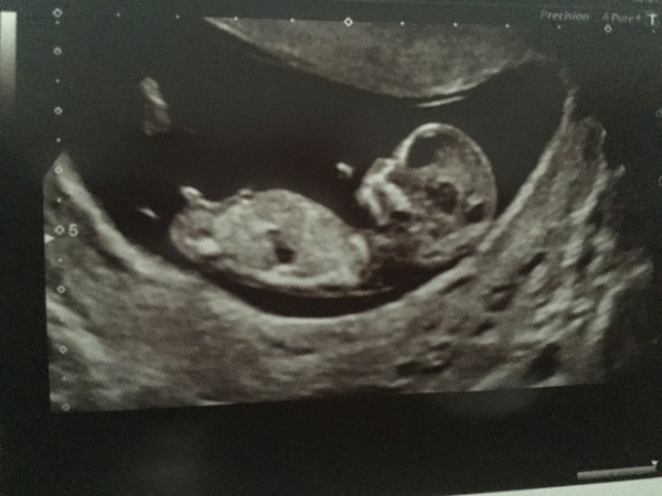 Christmas and new years babies thread!