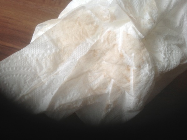 What would you do? Bleeding 3-4 weeks pregnant [graphic image warning added by MNHQ]