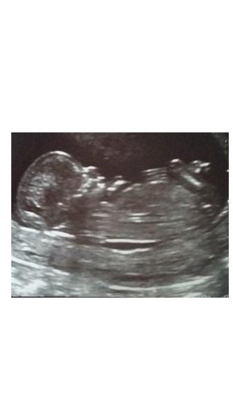 February '16 approaching and conquering the 12 week mark!