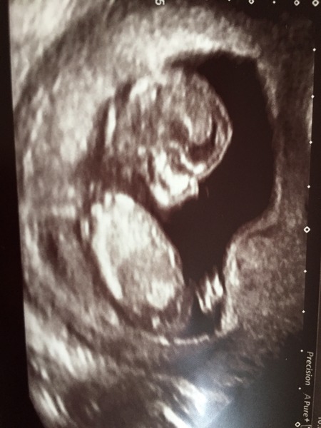 Jan 2016 #6 ....bumps and blooming ahoy!