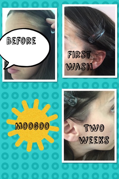 SMS- Save My Scalp!