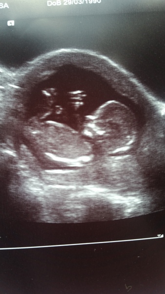 Jan 2016 #6 ....bumps and blooming ahoy!