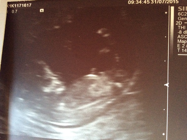 February '16 approaching and conquering the 12 week mark!