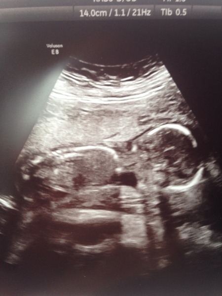 Gender scan today :) any last guesses on my scan pic?