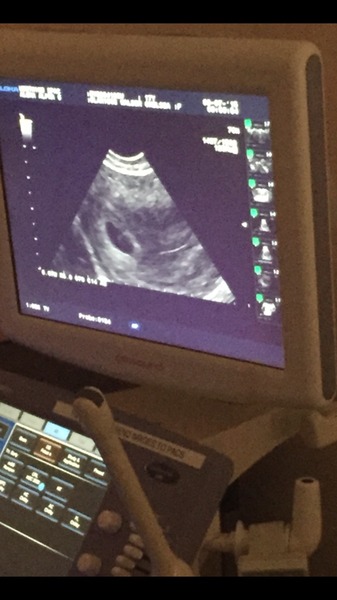 i thought i was 6 weeks, scan said only 4-5 weeks, no embryo yet!????
